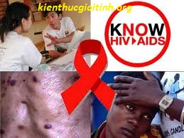 tìm hiểu về HIV/AIDS, tim hieu ve hiv aids