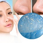 Cách trị mụn cám triệt để